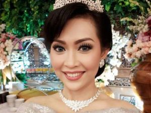 Fakta-fakta Oplas-Sedot Lemak, Rahasia Ratna Listy Tampak Awet Muda