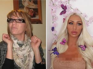 Wanita Berubah Total dengan Operasi Plastik, Penampilannya Dulu Beda Banget