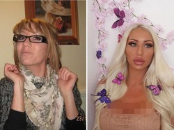 Wanita Berubah Total dengan Operasi Plastik, Penampilannya Dulu Beda Banget