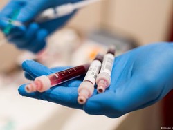 Antibodi pada Bayi, Virus Corona Tetap Menyimpan Banyak Misteri