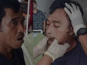 Viral Tak Bisa Mingkem Gegara Tertawa Lebar, Ini Pertolongan Pertamanya Viral Tak Bisa Mingkem Gegara Tertawa Lebar, Ini Pertolongan Pertamanya