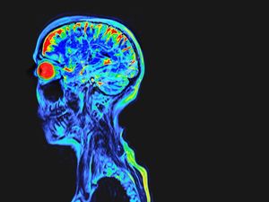 Cerita Psikiater Tangani Pasien Kesurupan, Tak Tahunya Idap Epilepsi
