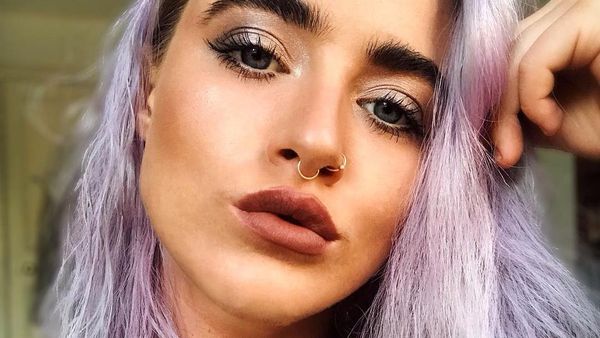 Kejutkan Follower, Selebgram Ungkap Kondisi Wajah Asli yang Jerawatan Parah