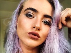 Kejutkan Follower, Selebgram Ungkap Kondisi Wajah Asli yang Jerawatan Parah Kejutkan Follower, Selebgram Ungkap Kondisi Wajah Asli yang Jerawatan Parah