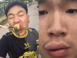 Ngakak! Makan Madu dari Sarangnya, Bibir Pria Ini Jadi Jontor