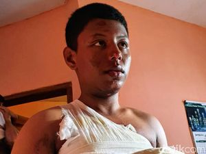 Santri di Bondowoso Diduga Dianiaya 14 Temannya hingga Alami Luka Bakar