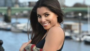 Foto: Influencer Glamour yang Sejak Usia 13 Tahun Sudah Operasi Plastik