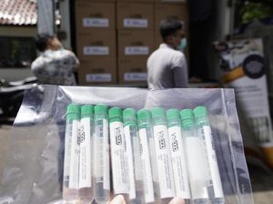 26 Ribu VitPAD Buatan Unpad Didistribusi ke RS Pendidikan di Indonesia