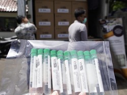 26 Ribu VitPAD Buatan Unpad Didistribusi ke RS Pendidikan di Indonesia