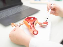 Adakah Obat Alami Kanker Serviks Tanpa Operasi? Hati-hati, Begini Kata Dokter