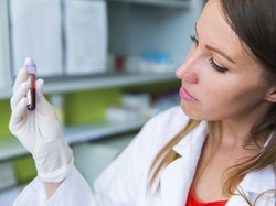 Diet Golongan Darah B, Ini Makanan yang Dianjurkan dan Dipantang