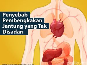 Sering Tak Disadari, 12 Hal Ini Bisa Picu Pembengkakan Jantung