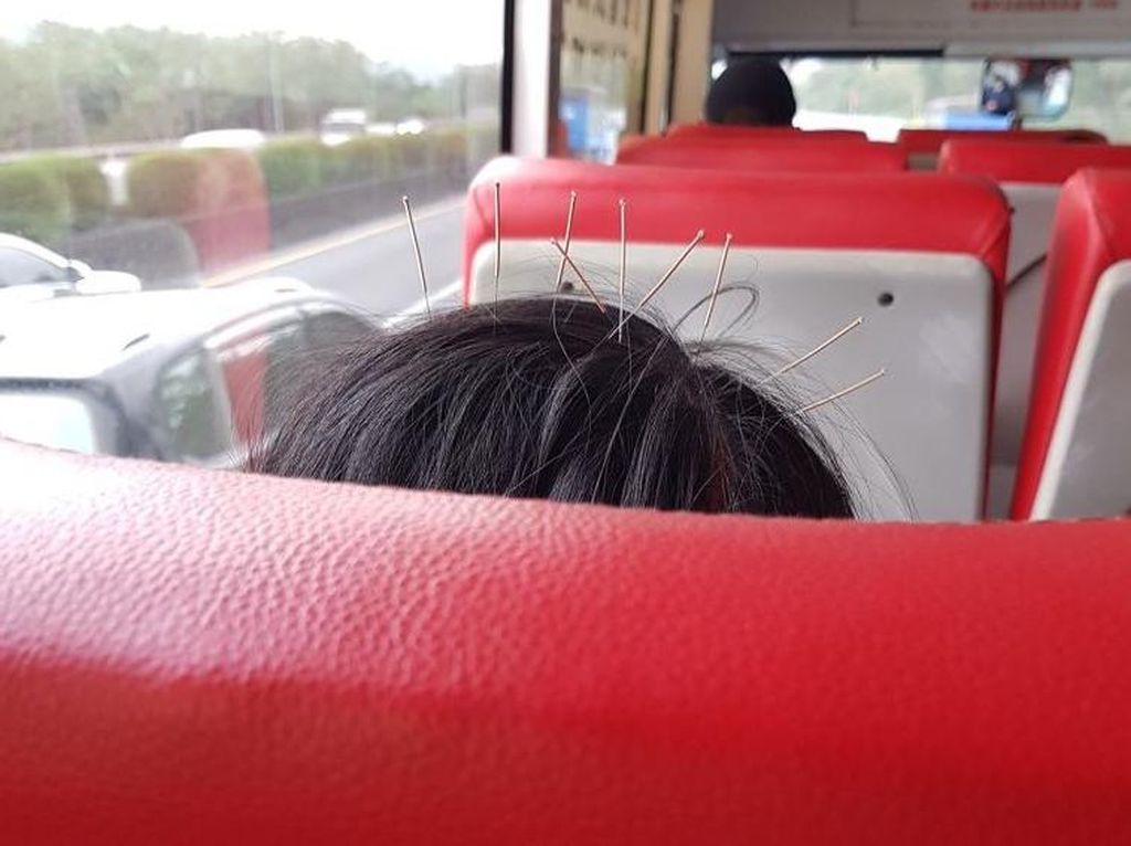 Viral Aksi Nekat Wanita Naik Bus dengan Kondisi 9 Jarum Tertusuk di Kepala Viral Aksi Nekat Wanita Naik Bus dengan Kondisi 9 Jarum Tertusuk di Kepala