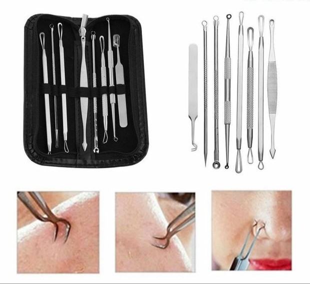 cara menghilangkan blackhead