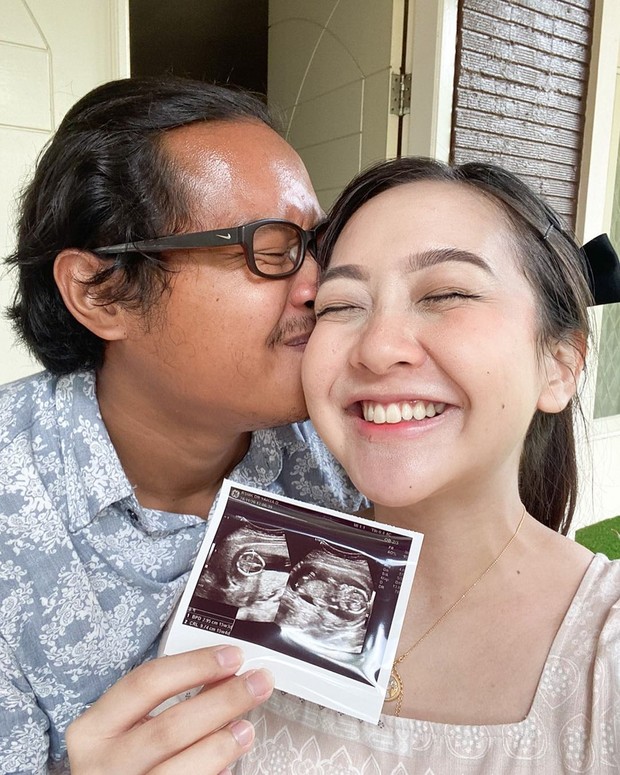Astari Riri & Suami/sumber: Instagram.com/iga_ramadana Influencer hamil