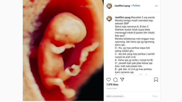Viral Anak SMP Hamil
