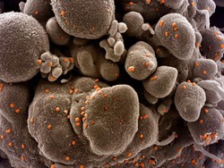 Virus Corona Mutasi di Inggris Menyebar Kian Cepat, Tapi Tidak Mematikan?