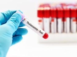 Thalasemia