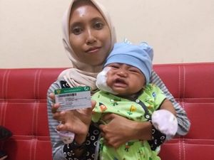 Ada JKN-KIS, Bayi 3 Bulan Bisa Operasi Tumor Gratis