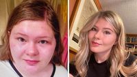 Dulu Dibilang Jelek, Kini Mereka Glow Up