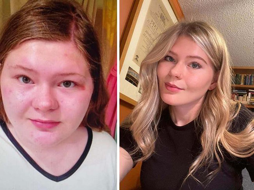 Dulu Dibilang Jelek, Kini Mereka Glow Up Dulu Dibilang Jelek, Kini Mereka Glow Up