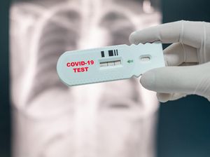 Polisi Selidiki 1 Klinik Diduga Lakukan Rapid Test Ilegal di Daerah Senen