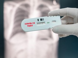 Polisi Selidiki 1 Klinik Diduga Lakukan Rapid Test Ilegal di Daerah Senen