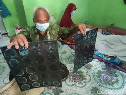 Siswa MTs di Kediri Depresi Berat Diduga Karena Ditegur Guru soal Tugas