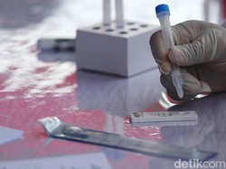 Masa Berlaku Rapid Antigen Cuma 3 Hari, BPKN: Sangat Pendek
