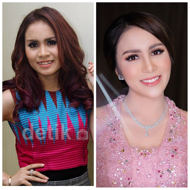 https://hot.detik.com/ https://www.instagram.com/therealmomogeisha/ Sejak mengawali karier sebagai vokalis band Geisha, Momo Geisha diketahui memiliki gigi gingsul. Namun, seiring berjalannya waktu, ia memilih menghilangkan gigi gingsulnya.
