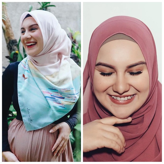 https://www.instagram.com/_irishbella_/ Meski membuat senyumnya terlihat manis, Irish Bella mengaku kurang percaya diri dengan gigi gingsulnya. Ia pun memutuskan menggunakan behel serta menghilangkan gigi gingsul.