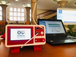 Tes Corona Murah Meriah Ala UGM Kisaran Rp 15-25 Ribu, Segini Akurasinya