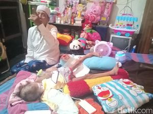 Kasihan, Tangan Bocah 5 Tahun di Madiun Ini Membesar Karena Kanker Tulang Kasihan, Tangan Bocah 5 Tahun di Madiun Ini Membesar Karena Kanker Tulang