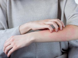 Ciri-ciri Penyakit Ginjal yang Terlihat di Kulit, Jangan Anggap Sepele