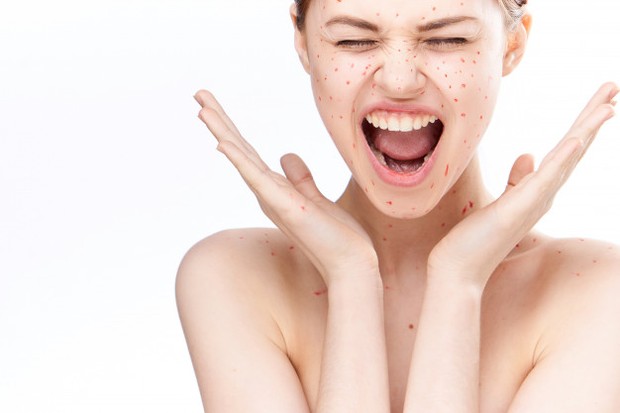 Fungal Acne Safe menjadi salah satu permasalahan kulit yang banyak dibahas selama tahun 2020/freepik.com