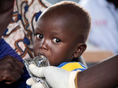 COVID-19 di Negara Konflik Picu Malnutrisi Anak-anak
