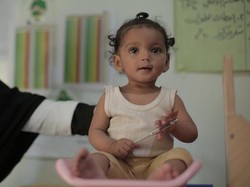 Malnutrisi Adalah: Ciri dan Penyebabnya