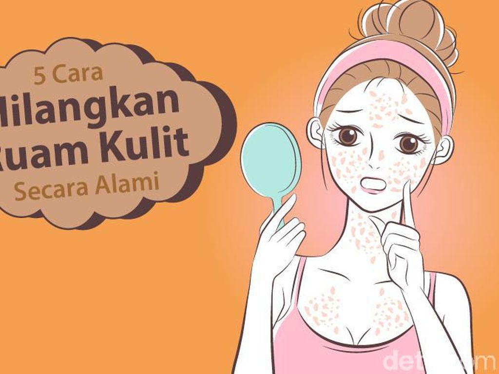 Jadi Salah Satu Gejala COVID-19, Begini Menghilangkan Ruam Kulit Jadi Salah Satu Gejala COVID-19, Begini Menghilangkan Ruam Kulit