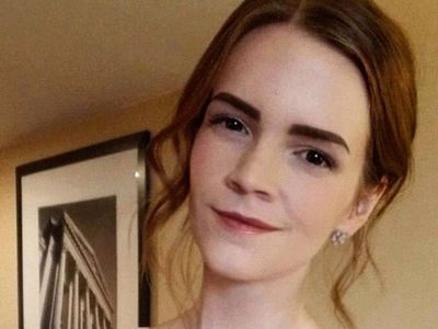 Foto: Wanita Viral Mirip Emma Watson Hingga Sulit Dibedakan Ibunya Sendiri