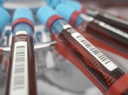 Bolehkah Saya Tes DNA Anak untuk Membuktikan Istri Berzina?