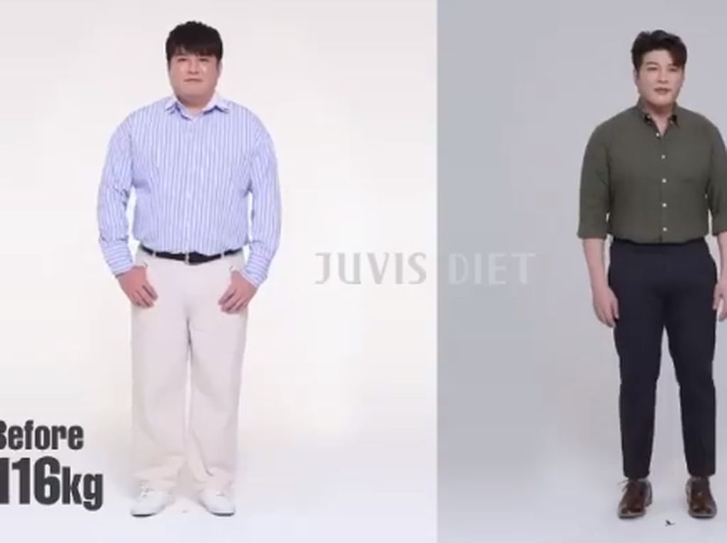 Jalani Juvis Diet, Shindong Super Junior dan Park Bom Sukses Turunkan BB Jalani Juvis Diet, Shindong Super Junior dan Park Bom Sukses Turunkan BB