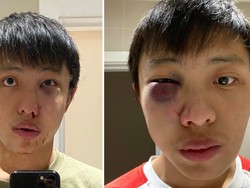 Pelaku Serangan Rasis Atas Mahasiswa Singapura Divonis Bersalah