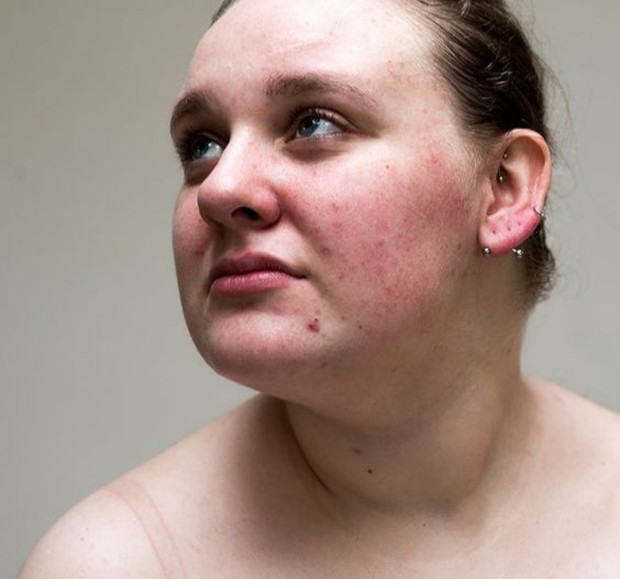 Berani jujur pada kulitmu sendiri/Foto: Pinterest/itsnicethat skin positivity