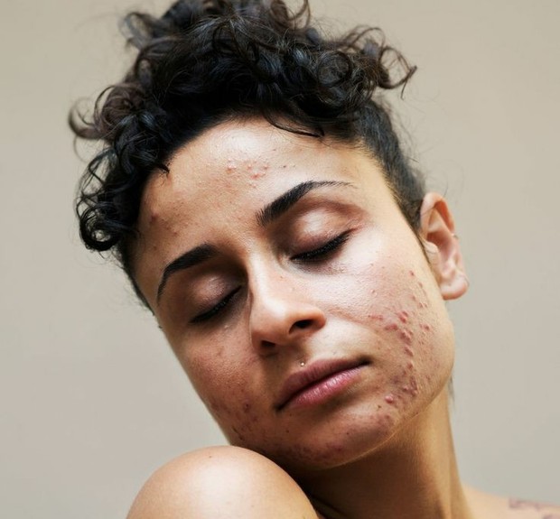 Selalu bersyukur atass apa yang kamu punya/Foto: Pinterest/glamourmaguk skin positivity