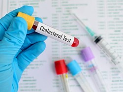 Panas Dingin-Lemas Nyaris Pingsan, Mungkinkah karena Kolesterol Tinggi Dok?