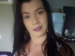 Implan Silikon di Bokong Bocor Sampai Kaki, Wanita Ini Terancam Diamputasi