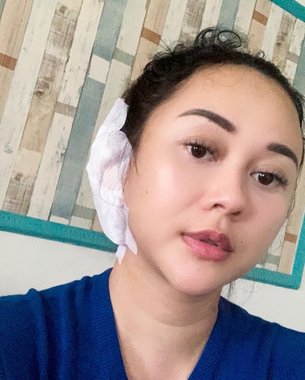 Aura Kasih/Instagram.com/Aurakasih Aura Kasih terpapar COVID-19