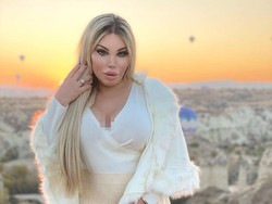 Transgender Kontroversial Habiskan Rp 1,5 M untuk Oplas Dada Sampai Kelamin