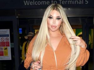 Ingin Jadi Wanita Seutuhnya, Transgender Ini Berencana Transplantasi Rahim