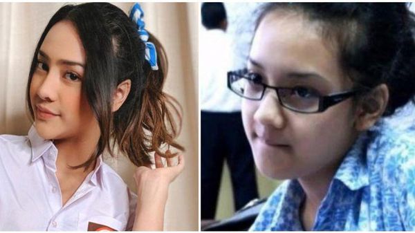 Foto Wajah 7 Selebgram Indonesia Dulu & Kini, Manglingi Sampai Bikin Kaget